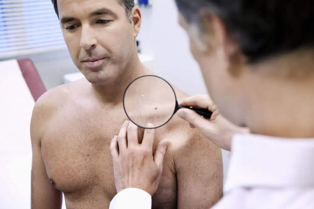 A doctor conducting a skin cancer screening on a patient.